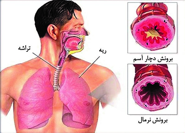 آسم